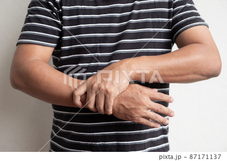 man hand with numbness and pain in the wrist has pain and tingling in the nerve endings. which is a side effect of Guillain-Barre Syndrome after vaccination against COVID-19 man hand with numbness and pain in the wrist has pain and tingling in the nerve endings. which is a side effect of Guillain-Barre Syndrome after vaccination against COVID-19 87171137