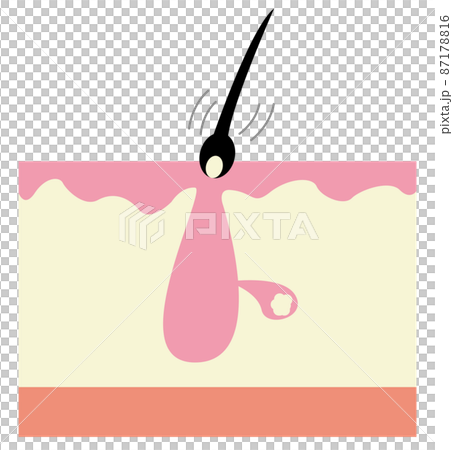 Pore image Pore image 87178816