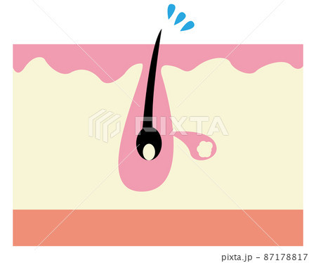 毛穴イメージ 87178817