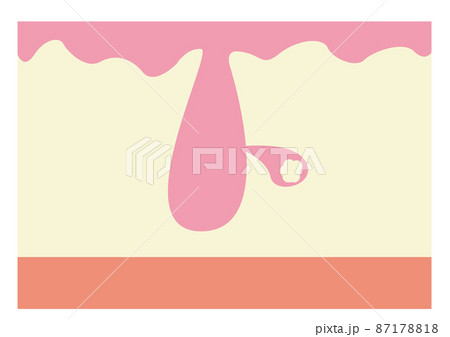 毛穴イメージ 毛穴イメージ 87178818