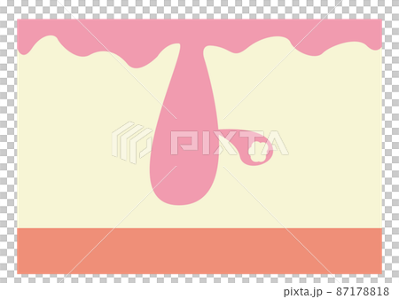 毛穴イメージ 毛穴イメージ 87178818