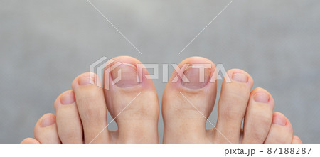 Closeup of female feet and toes. Healthy feet concept Closeup of female feet and toes. Healthy feet concept 87188287