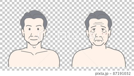 Before After Aging Wrinkles Spots Skin Trouble Men Men's Beauty 87191032