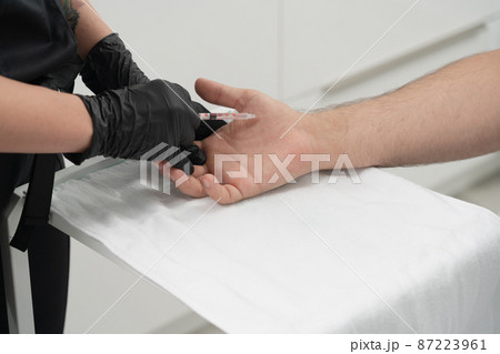 doctor makes a shot of botulinum toxin in the hand of a male palm against excessive sweating, treatment of hyperhidrosis 87223961