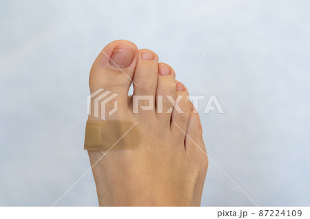 Medical plaster on the female feet. Wound healed with a band aid for medical care Medical plaster on the female feet. Wound healed with a band aid for medical care 87224109
