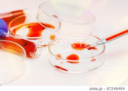 Coronavirus blood sample COVID-19. Petri dish and test tubes with blood in the laboratory. Blood coronavirus test.Virus vaccine development.Pipette and petri dish.Virus research. Coronavirus blood sample COVID-19. Petri dish and test tubes with blood in the laboratory. Blood coronavirus test.Virus vaccine development.Pipette and petri dish.Virus research. 87246464