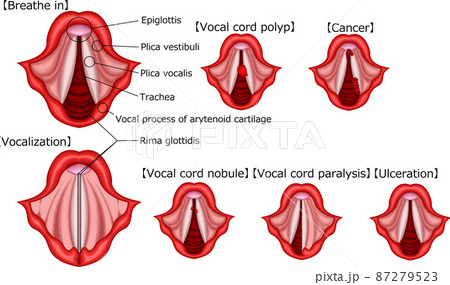 声帯　イラスト　英語 87279523