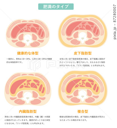 肥満のタイプ 肥満のタイプ 87280007