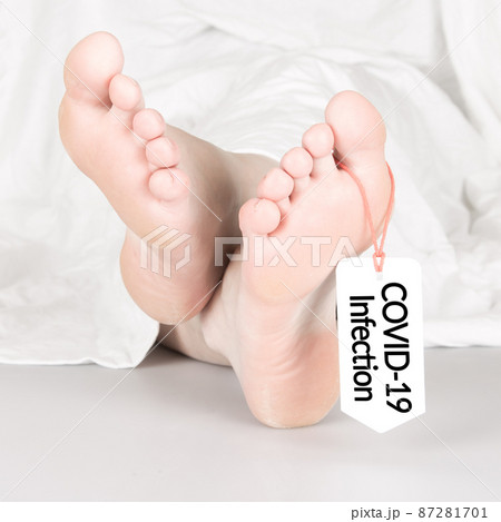 Body with toe tag on white 87281701