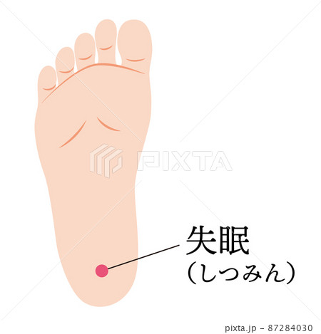 足のツボ 失眠 足のツボ 失眠 87284030