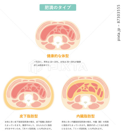 肥満のタイプ02 87303555