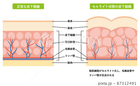 血管組織図