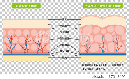 Subcutaneous tissue cross section 02 Subcutaneous tissue cross section 02 87312491