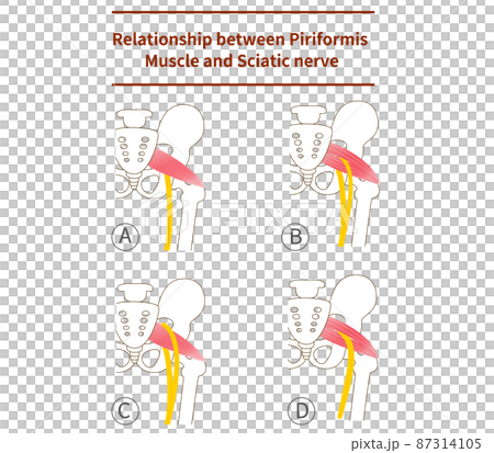 Illustration of piriformis and sciatic nerve 87314105