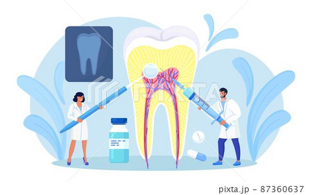 Dentists cleaning and treating big unhealthy tooth with caries cavity. Toothache. Stomatology, Dentistry concept. Doctors with professional instruments for check up and treatment. Dentist appointment 87360637