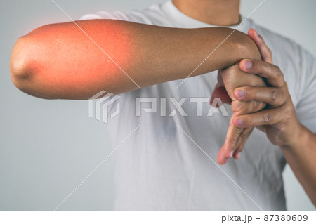 Elbow injury from tennis and golf. The man uses fingers to massage and stretch his arm. Pain symptom area is shown with red color. Healthcare knowledge. Medium close up shot. Elbow injury from tennis and golf. The man uses fingers to massage and stretch his arm. Pain symptom area is shown with red color. Healthcare knowledge. Medium close up shot. 87380609