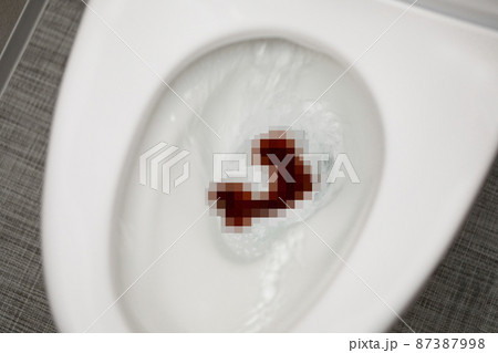 使用したトイレのイメージ (モザイク処理) 使用したトイレのイメージ (モザイク処理) 87387998