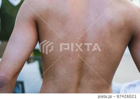 body body 87426021