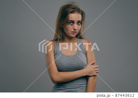 Blonde girl with bruises on her face posing against gray studio background. Domestic violence, abuse. Depression, despair. Close-up, copy space. 87443612