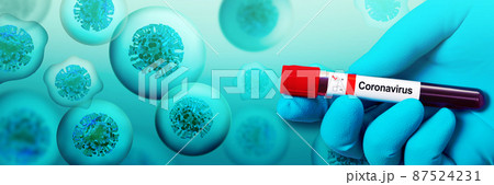 Doctor holding a blood sample with corona virus. 3d illustration 87524231