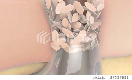 clogged pores, dead skin cells 87537631