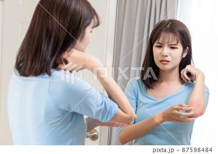 woman scratching her arms 87598484