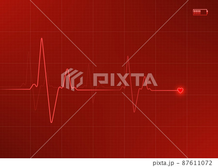 Electrocardiogram illustration in red color with battery icon 87611072