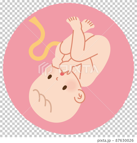 肚子裡的嬰兒，胎兒 87630026