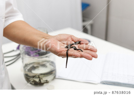Medical leeches in the hand of a traditional medicine clinic doctor Medical leeches in the hand of a traditional medicine clinic doctor 87638016