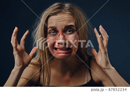 Frightened lady in black t-shirt. Bleeding face covered with bruises, raised her hands up and crying, sitting against blue background. Close-up Frightened lady in black t-shirt. Bleeding face covered with bruises, raised her hands up and crying, sitting against blue background. Close-up 87652234