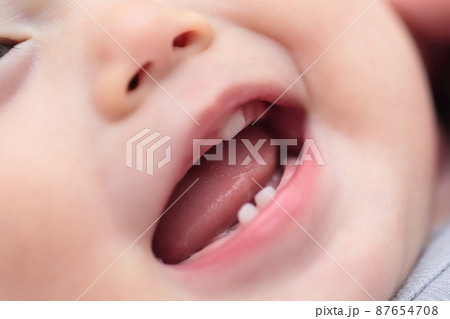 0歳の赤ちゃんに生えた乳歯 87654708