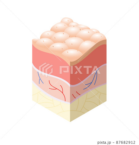 Skincare medical concept. Problems in cross-section of human skin horizontal layers structure. Anatomy illustrative model Skincare medical concept. Problems in cross-section of human skin horizontal layers structure. Anatomy illustrative model 87682912