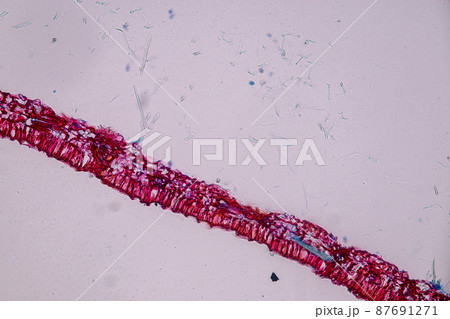 Host cells with spores (mold) are inside wood under the microscope for education. 87691271