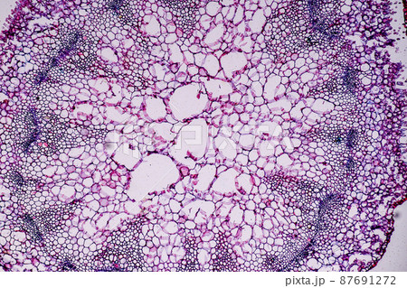 Host cells with spores (mold) are inside wood under the microscope for education. 87691272