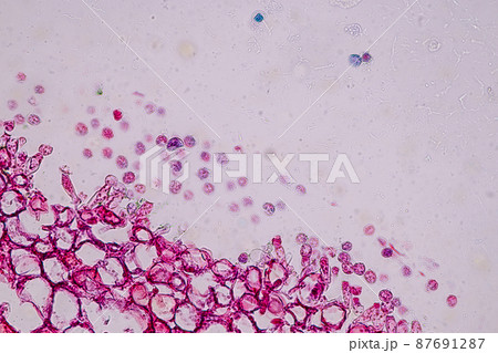 Host cells with spores (mold) are inside wood under the microscope for education. 87691287