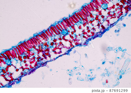 Host cells with spores (mold) are inside wood under the microscope for education. 87691299