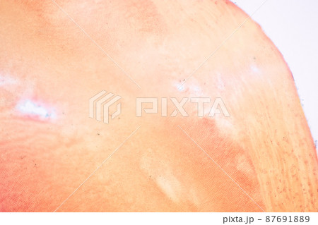 Tooth development from human under microscope view for education. 87691889