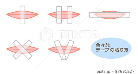 テープの貼り方 87691927
