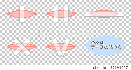 テープの貼り方 87691927