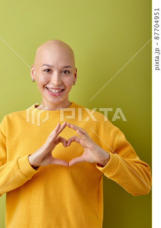Laughing. pretty caucasian bald woman posing on green studio background. 87704951