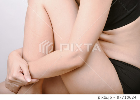 Belly fat, Obesity woman sitting with peak out belly fat, Overweight woman showing muffin 87710624