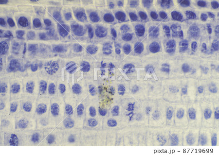 植物細胞の有糸分裂　顕微鏡画像 87719699