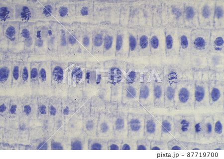 植物細胞の有糸分裂 顕微鏡画像 植物細胞の有糸分裂 顕微鏡画像 87719700