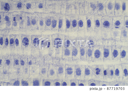 植物細胞の有糸分裂　顕微鏡画像 87719703