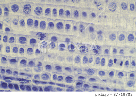 植物細胞の有糸分裂 顕微鏡画像 植物細胞の有糸分裂 顕微鏡画像 87719705