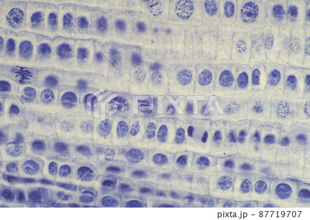 植物細胞の有糸分裂 顕微鏡画像 植物細胞の有糸分裂 顕微鏡画像 87719707