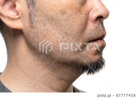 無精ひげのミドル男性　シミ　毛穴汚れ　スキンケア 87777458