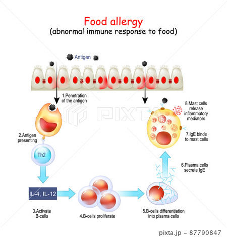 Food allergy. abnormal immune response to food. Food allergy. abnormal immune response to food. 87790847