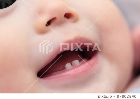 0歳の赤ちゃんに生えた乳歯 87802840