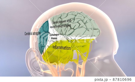 Amyloid Precursor Protein Processing and Alzheimer s Disease 87810696